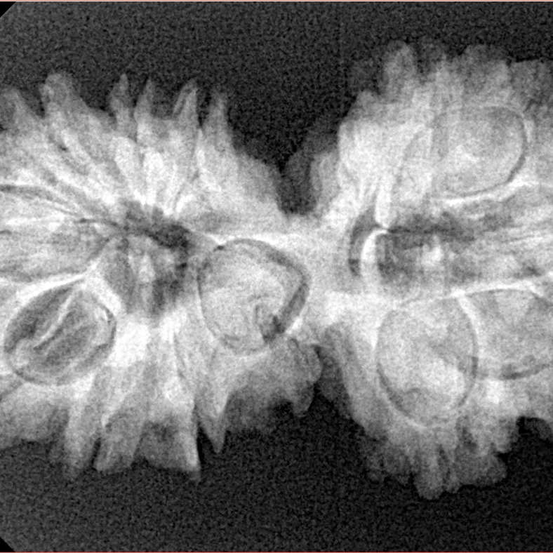 14 Mukhi Gaurishankar 33.2mm 5.56gm - Xray
