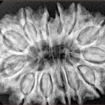 13 Mukhi Rudraksha 33.9mm 7gm - Xray