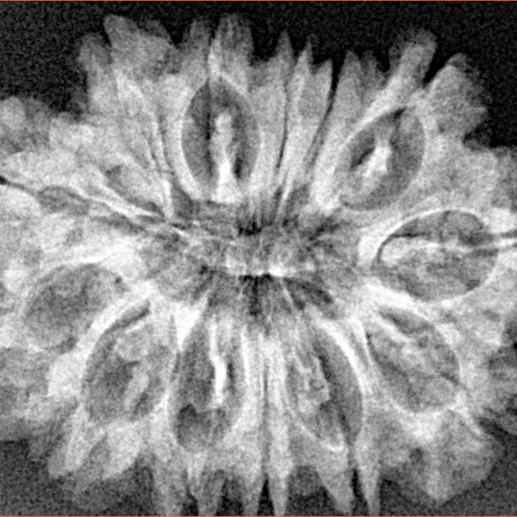 13 Mukhi Rudraksha 28.4mm 4.16gm - Xray