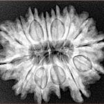 14 Mukhi Rudraksha 27.4mm 5gm - Xray