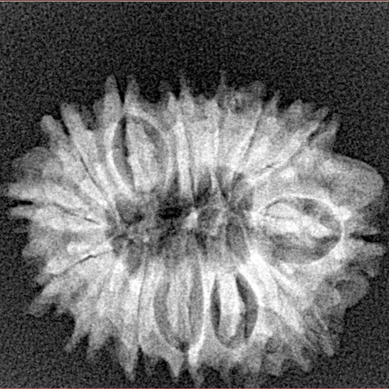 14 Mukhi Rudraksha 24.3mm 2.82gm - Xray