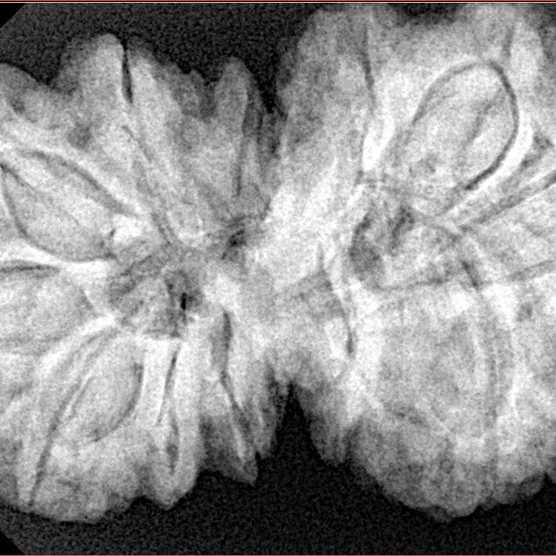 13 Mukhi Gaurishankar 38mm 9.74gm - Xray
