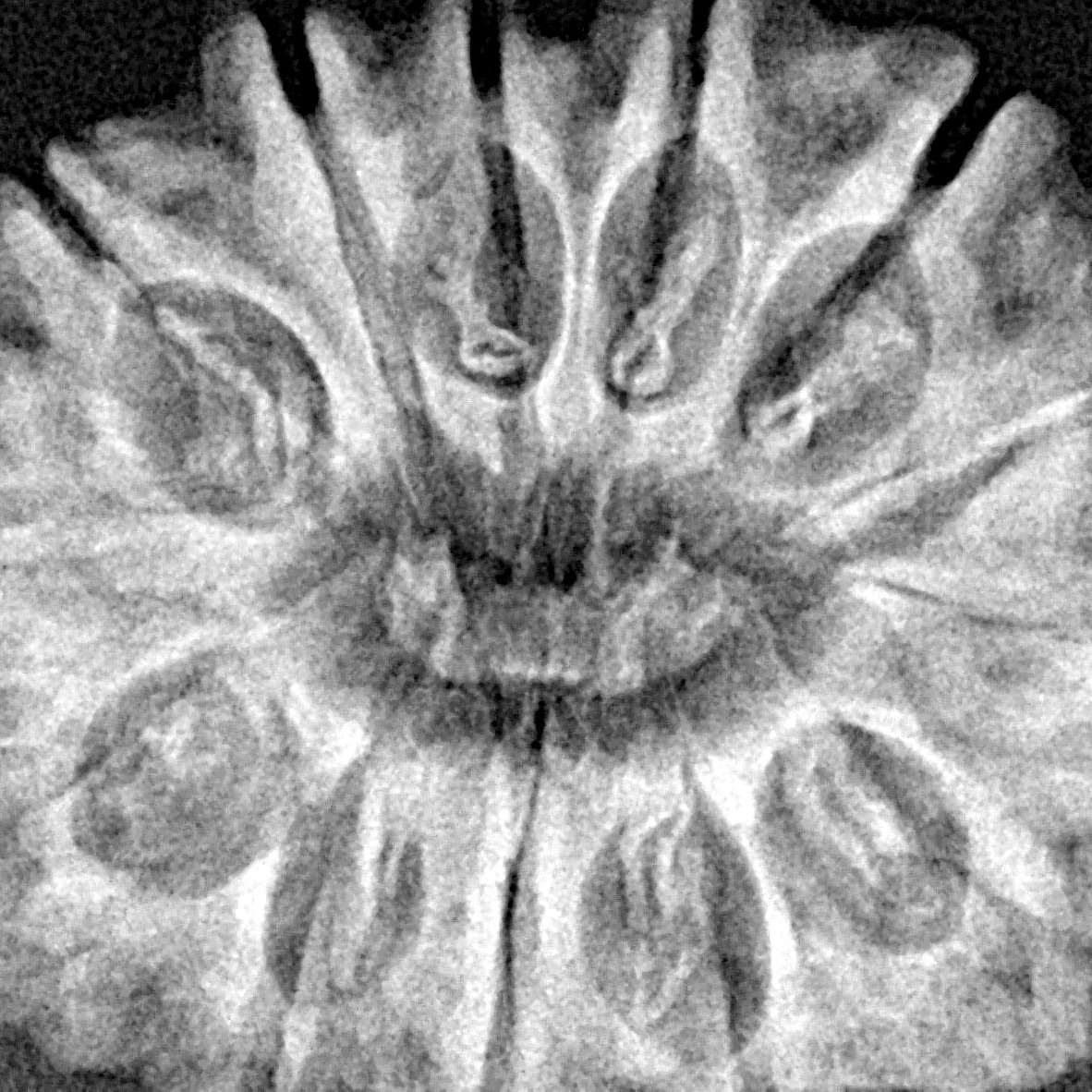 13 Mukhi Rudraksha 31.1mm 6.58gm - Xray