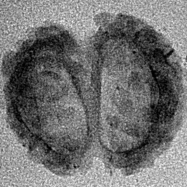 2 Mukhi Gaurishankar 19.1mm 0.74gm - Inverse xray