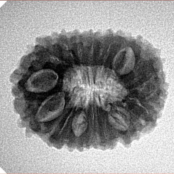 16 Mukhi Rudraksha 23mm 3.09gm - Inverse xray