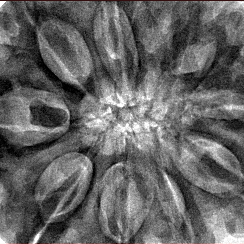 10 Mukhi Rudraksha 36.2mm 11.2gm - Inverse xray