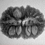 18 Mukhi Rudraksha 24.1mm 2.74gm - Inverse xray