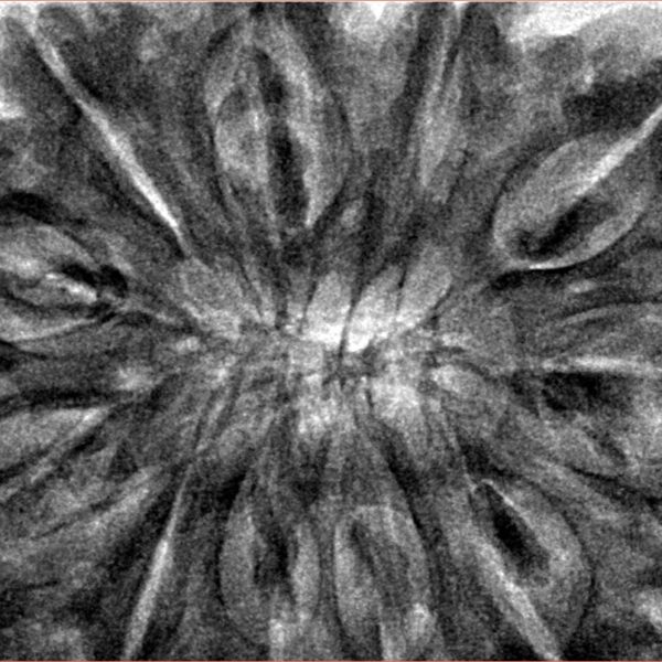 11 Mukhi Rudraksha 39.5mm 11.34gm - Inverse xray