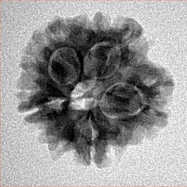 1MK(Underdeveloped) 19.5mm 2.57gm - Inverse xray