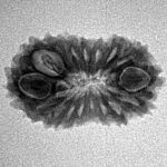 17 Mukhi Rudraksha 22.4mm 1.77gm - Inverse xray