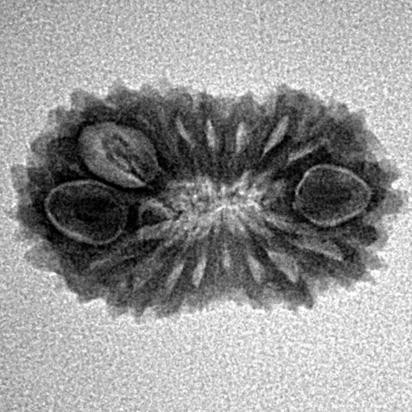 17 Mukhi Rudraksha 22.4mm 1.77gm - Inverse xray