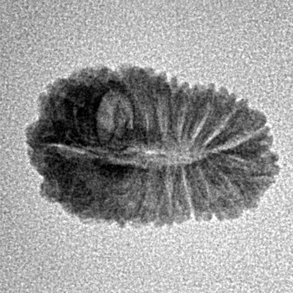 20 Mukhi Rudraksha 18.7mm 1.08gm - Inverse xray