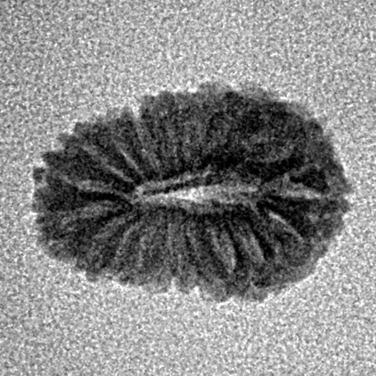 19 Mukhi Rudraksha 14.9mm 0.59gm - Inverse xray