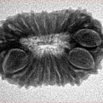 16 Mukhi Rudraksha 22.4mm 2.07gm - Inverse xray