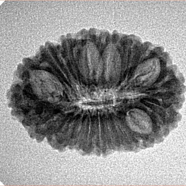 19 Mukhi Rudraksha 24.6mm 2.5gm - Inverse xray