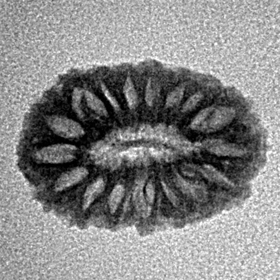 17 Mukhi Rudraksha 16.7mm 0.86gm - Inverse xray