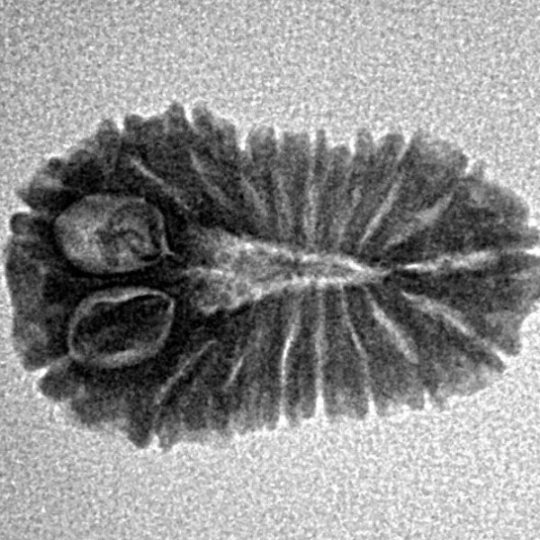 18 Mukhi Rudraksha 19.7mm 1.36gm - Inverse xray