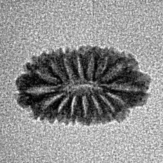 16 Mukhi Rudraksha 14.2mm 0.39gm - Inverse xray