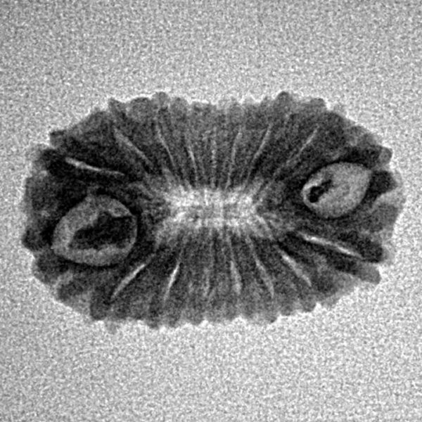 17 Mukhi Rudraksha 21.5mm 1.41gm - Inverse xray