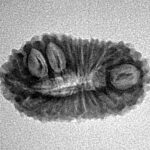 18 Mukhi Rudraksha 23.9mm 1.82gm - Inverse xray