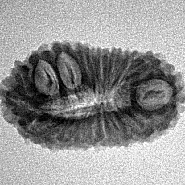 18 Mukhi Rudraksha 23.9mm 1.82gm - Inverse xray