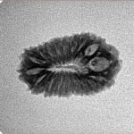 19 Mukhi Rudraksha 20mm 1.51gm - Origin: Indonesia - Inverse xray