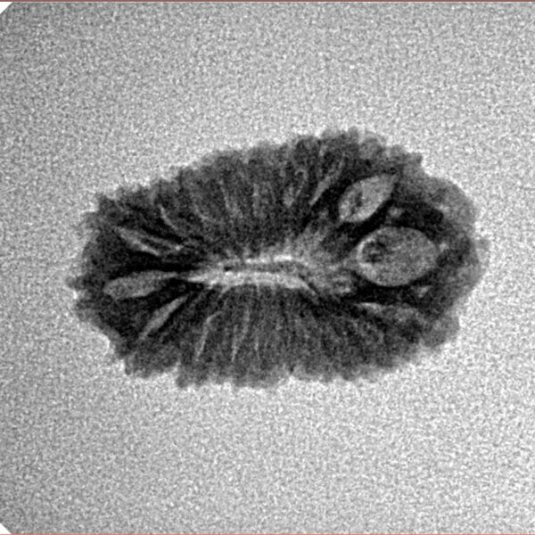 19 Mukhi Rudraksha 20mm 1.51gm - Origin: Indonesia - Inverse xray