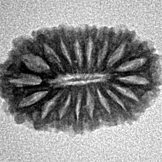 18 Mukhi Rudraksha 19.2mm 1.42gm - Inverse xray