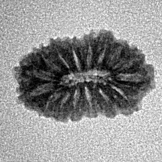 16 Mukhi Rudraksha 16.2mm 0.88gm - Inverse xray