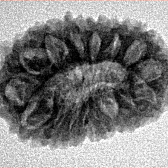 16 Mukhi Rudraksha 20.6mm 2gm - Inverse xray