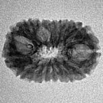 16 Mukhi Rudraksha 20.4mm 1.3gm - Inverse xray