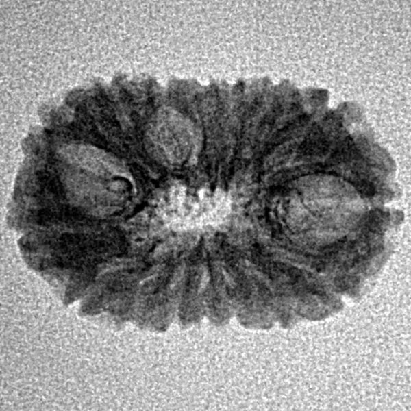 16 Mukhi Rudraksha 20.4mm 1.3gm - Inverse xray