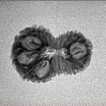 15 Mukhi Rudraksha 20.2mm 1.19gm - Inverse xray