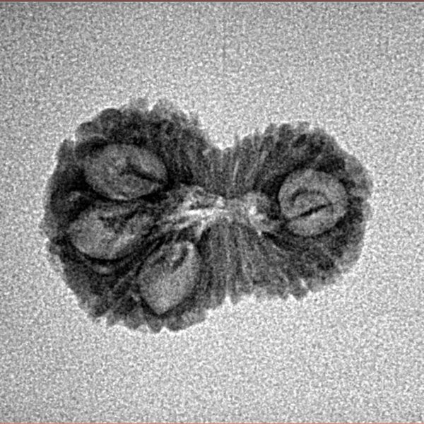 15 Mukhi Rudraksha 20.2mm 1.19gm - Inverse xray