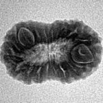 18 Mukhi Rudraksha 19.5mm 1.61gm - Inverse xray