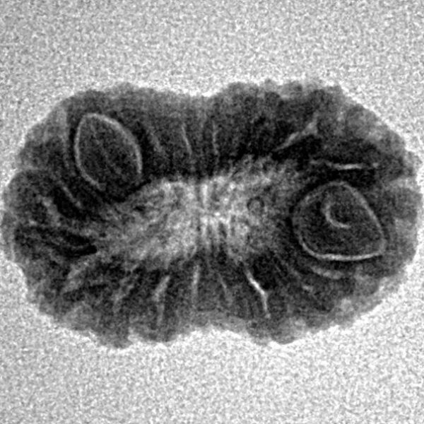 18 Mukhi Rudraksha 19.5mm 1.61gm - Inverse xray