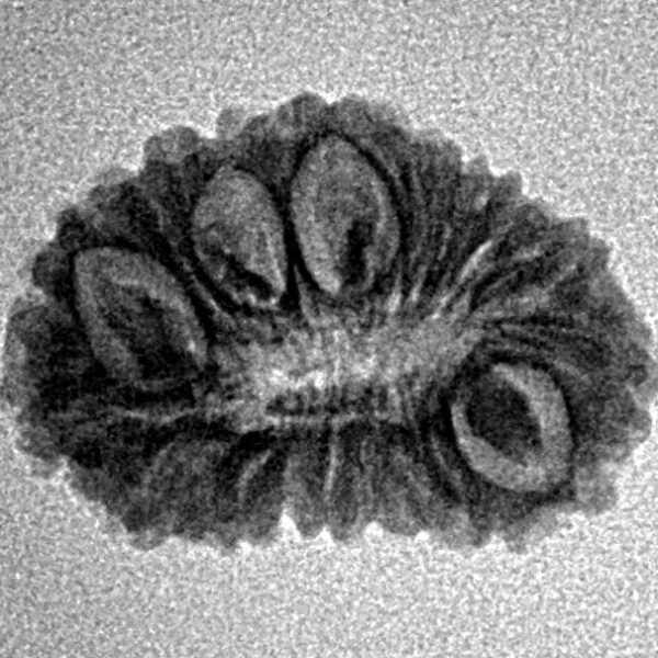 18 Mukhi Rudraksha 19.8mm 1.39gm - Inverse xray