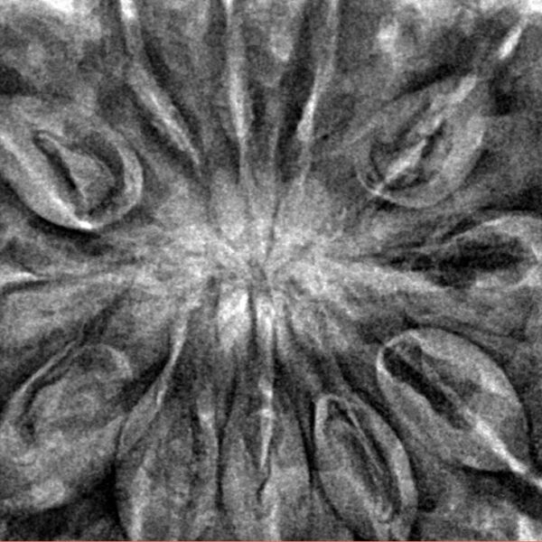 12 Mukhi Rudraksha 36.2mm 9.4gm - Inverse xray