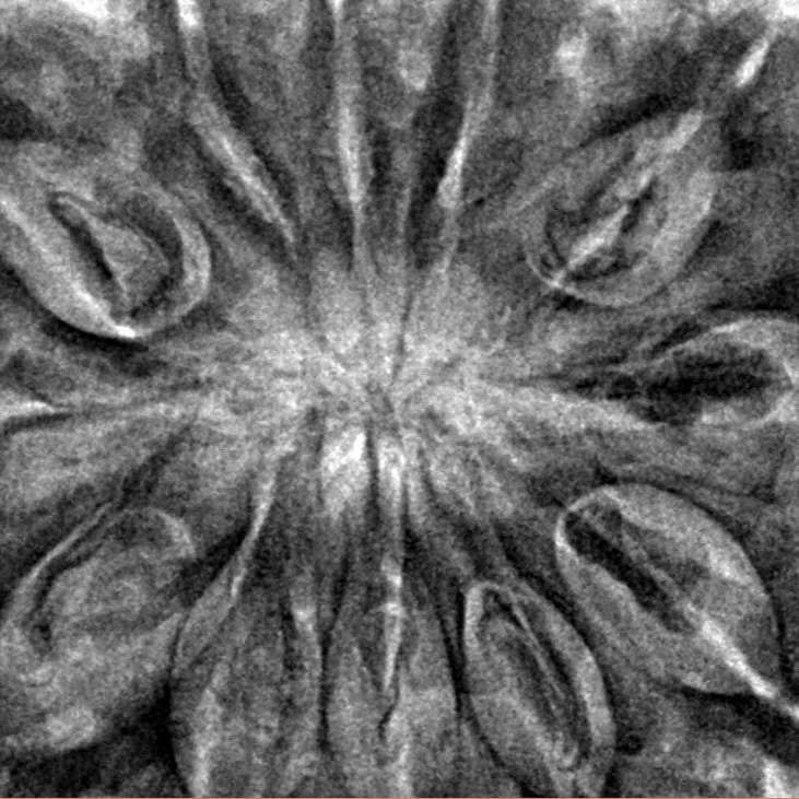 12 Mukhi Rudraksha 36.2mm 9.4gm - Inverse xray