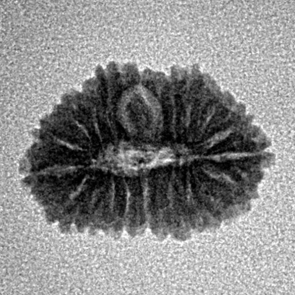 19 Mukhi Rudraksha 16.9mm 1.02gm - Inverse xray