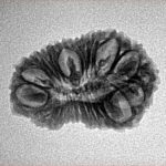 22 Mukhi Rudraksha 23.8mm 2.07gm - Inverse xray