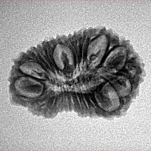 22 Mukhi Rudraksha 23.8mm 2.07gm - Inverse xray