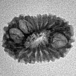 16 Mukhi Rudraksha 18.8mm 1.18gm - Inverse xray