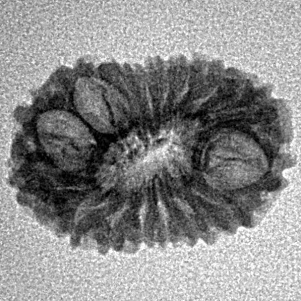 16 Mukhi Rudraksha 18.8mm 1.18gm - Inverse xray