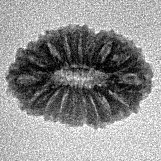 17 Mukhi Rudraksha 16.8mm 1gm - Inverse xray