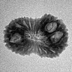 19 Mukhi Rudraksha 19.4mm 1.25gm - Inverse xray