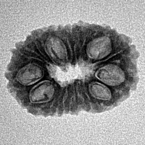 17 Mukhi Rudraksha 20mm 1.67gm - Inverse xray