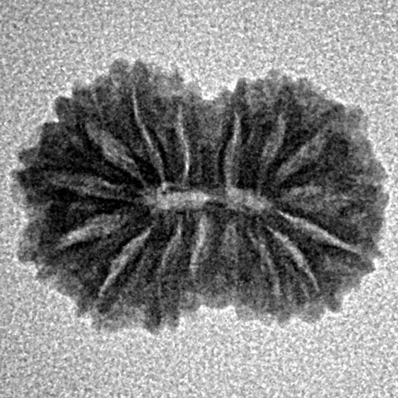 16 Mukhi Rudraksha 17.4mm 1.1gm - Inverse xray