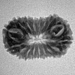 17 Mukhi Rudraksha 22.1mm 1.64gm - Inverse xray