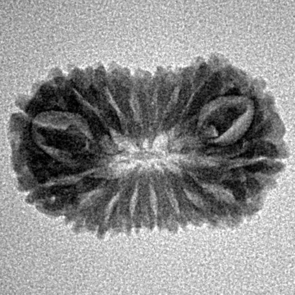 17 Mukhi Rudraksha 22.1mm 1.64gm - Inverse xray